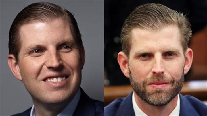 Eric Trump And The Speculations Surrounding His Plastic Surgery