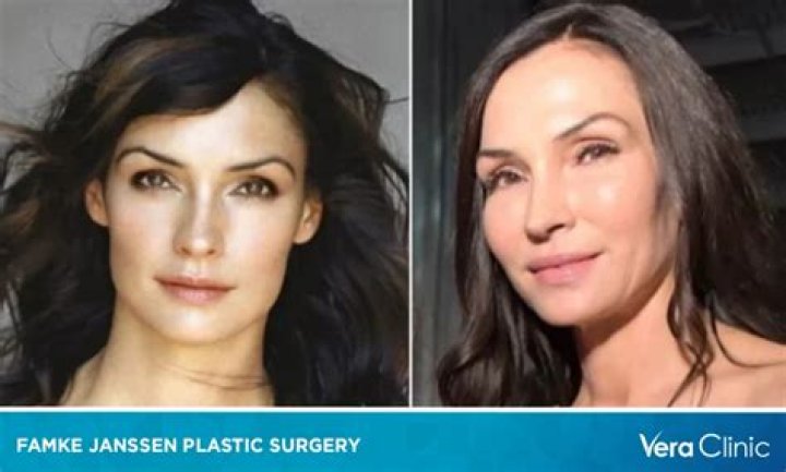 Unveiling The Truth Behind Famke Janssen Surgery