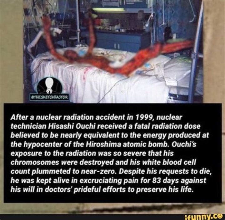 Unveiling The Tragic Journey: Hisashi Ouchi's Picture After Radiation