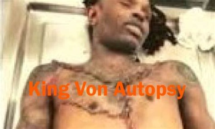 The Unseen Truth: King Von's Autopsy Report