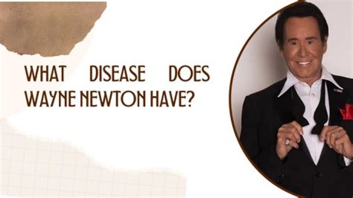 Comprehensive Guide To Wayne Newton's Health Condition And Disease